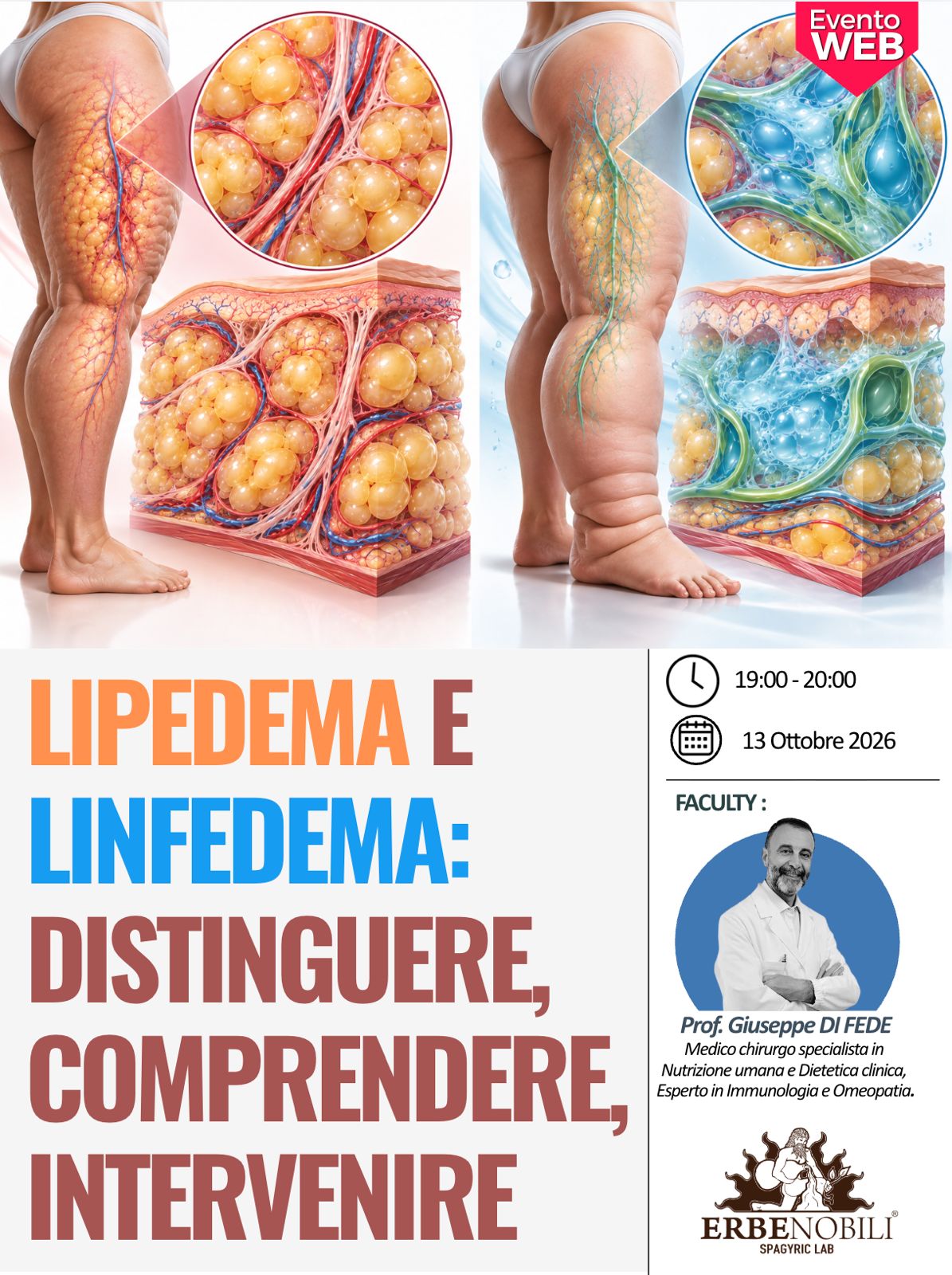 Lipedema e linfedema: distinguere, comprendere, intervenire